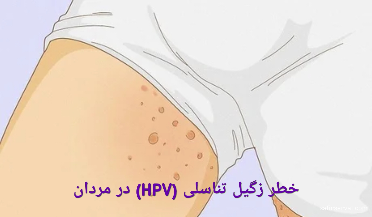 آیا زگیل تناسلی یا همان HPV در مردان خطرناک است؟